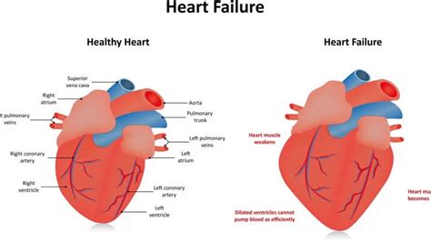 lv hypokinesis|what does severely hypokinetic mean.